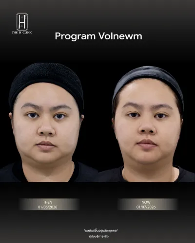 Volnewmer