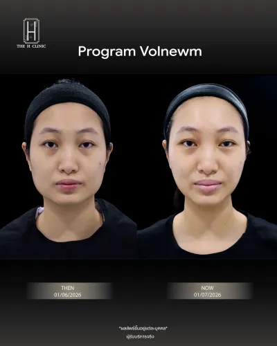 Volnewmer