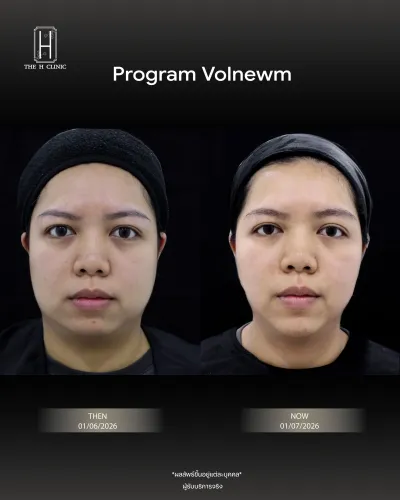 Volnewmer