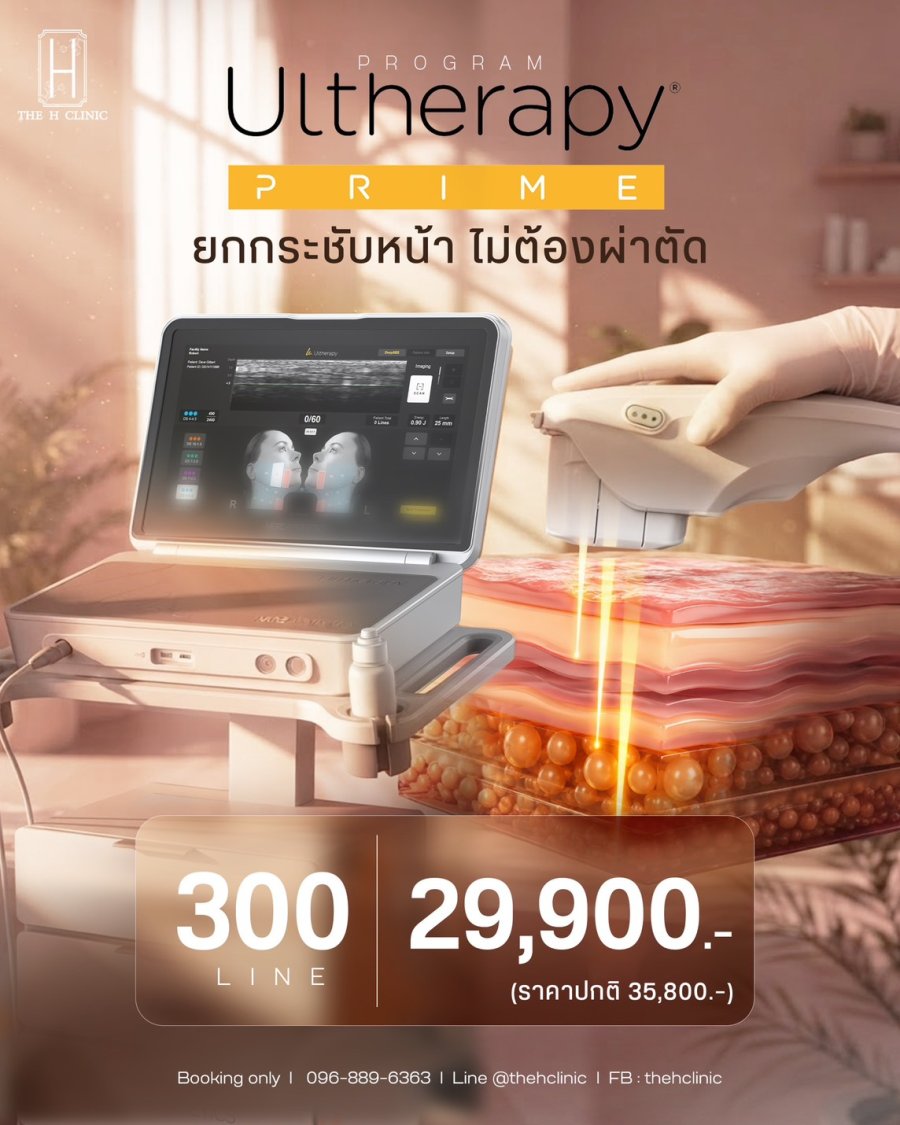 Ultherapy Prime 300 Line